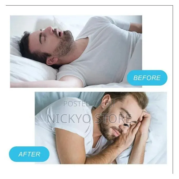 Magnetic Nasal Dilator Starter Kit
