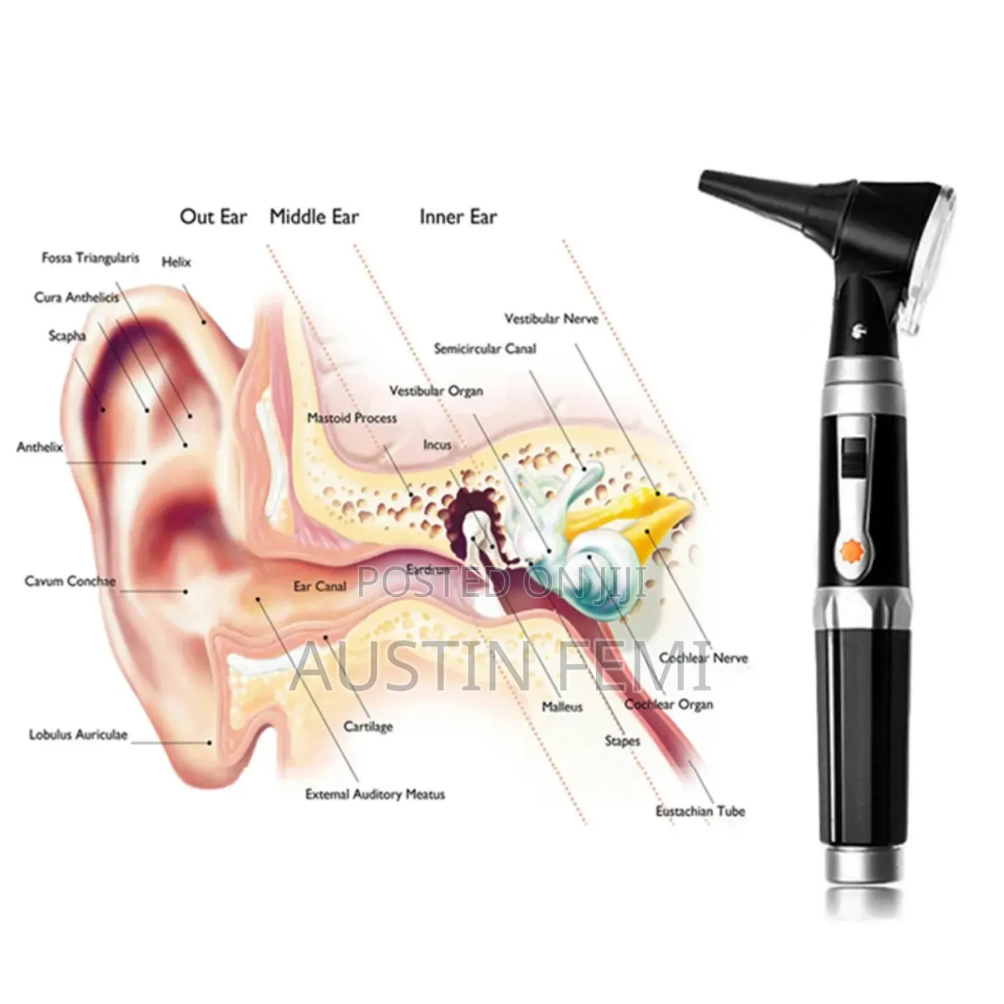 Premium Otoscope for Professional Use