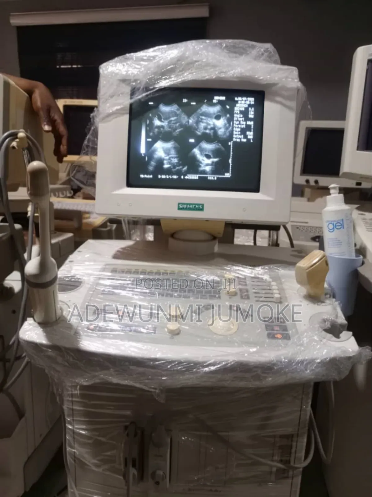 Siemens Prima With TVs Probe and Convex Probe