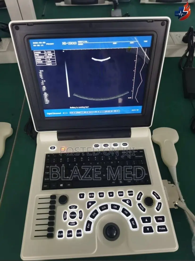 Portable Laptop Ultrasound Machine