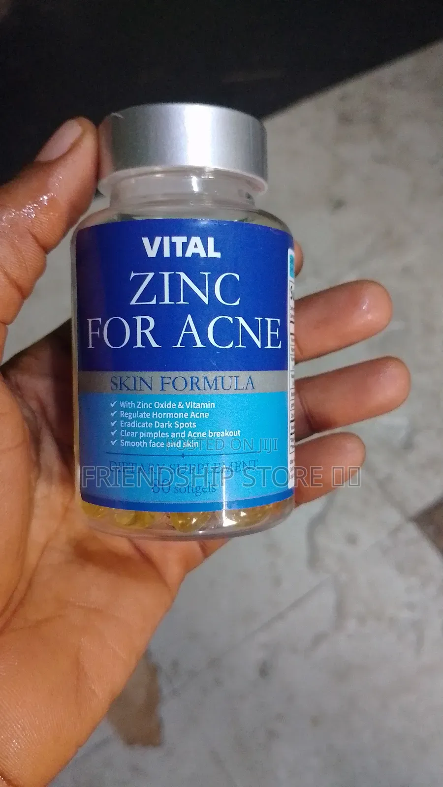 Zinc for Acne