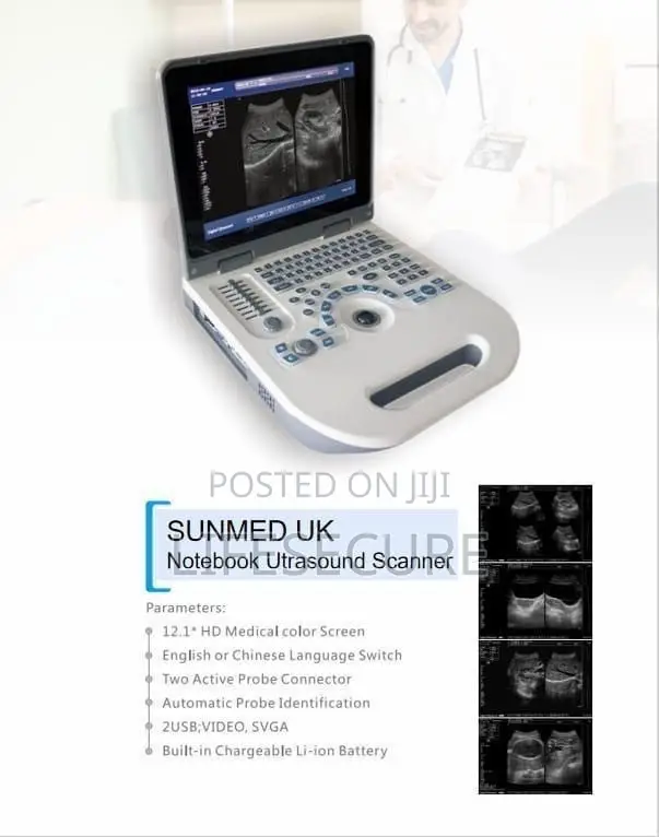 Sunmed UK Laptop Ultrasound With Curvilinear Probe