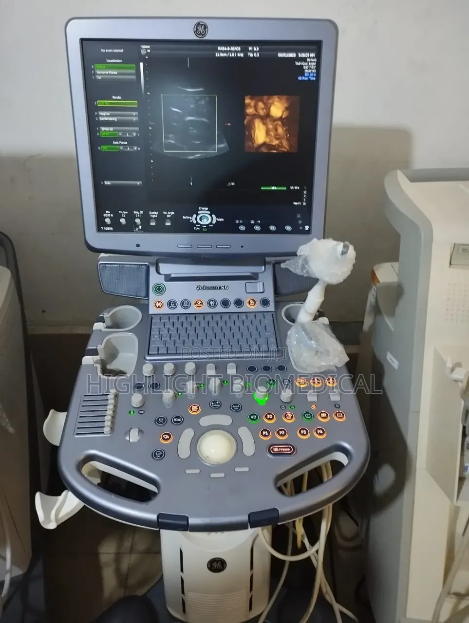 GE Voluson S6 With Volume Linear TVS Probe