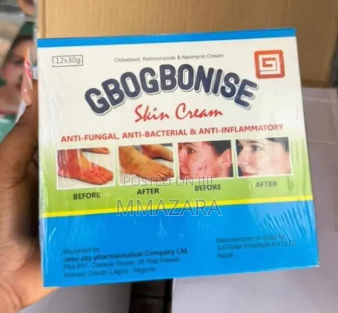Gbogbonise Tube Cream
