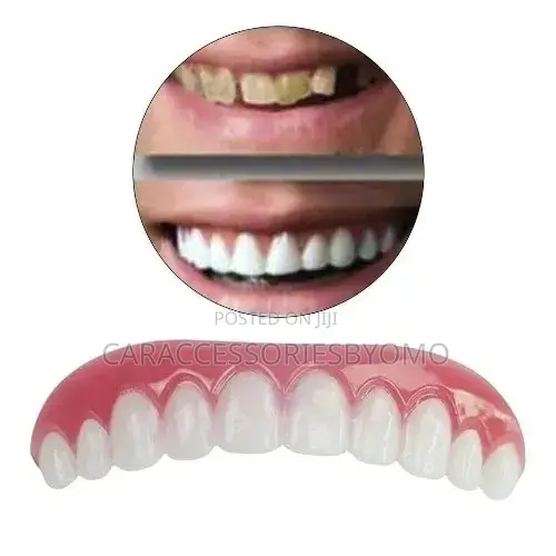 Perfect Smile Veneers