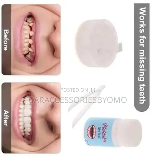 Temporary Tooth Repair Kit Dental Resin Repair - -20g