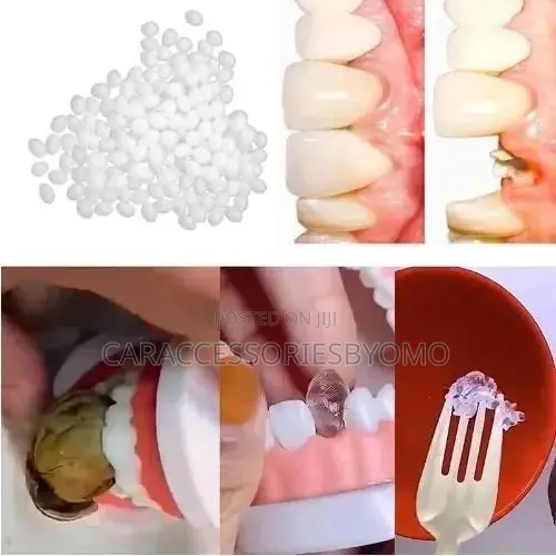 Temporary Tooth Repair Kit Dental Resin Repair - -20g