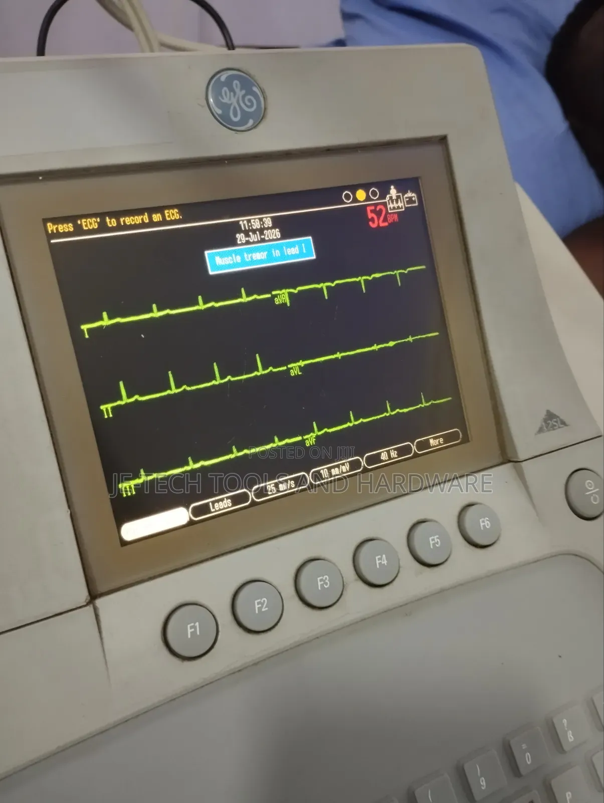 Ge Mac 3500 ECG Machine (12 Channel)