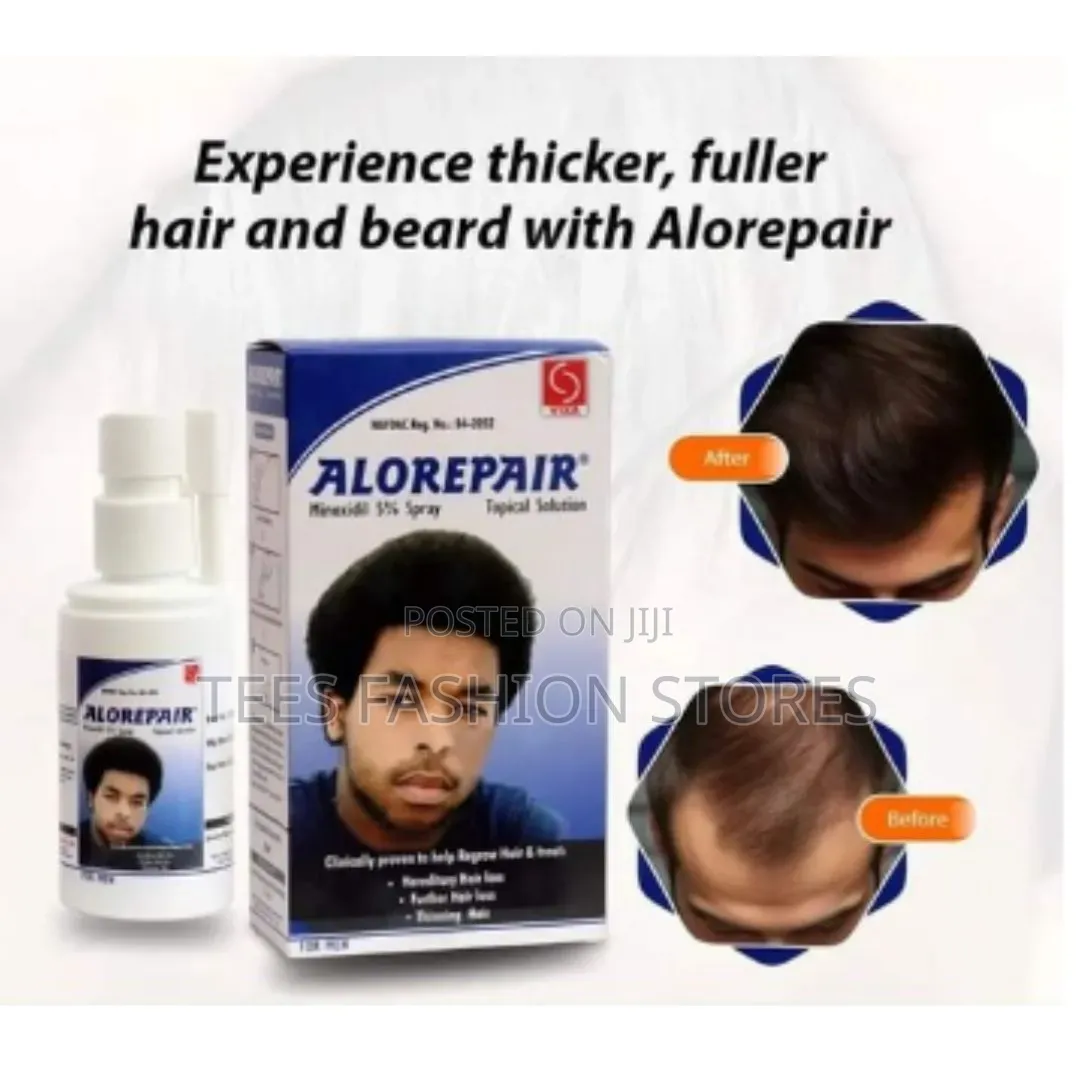 Alorepair Minoxidil 5% Spray - Thicker, Fuller Hair and Beard Growth
