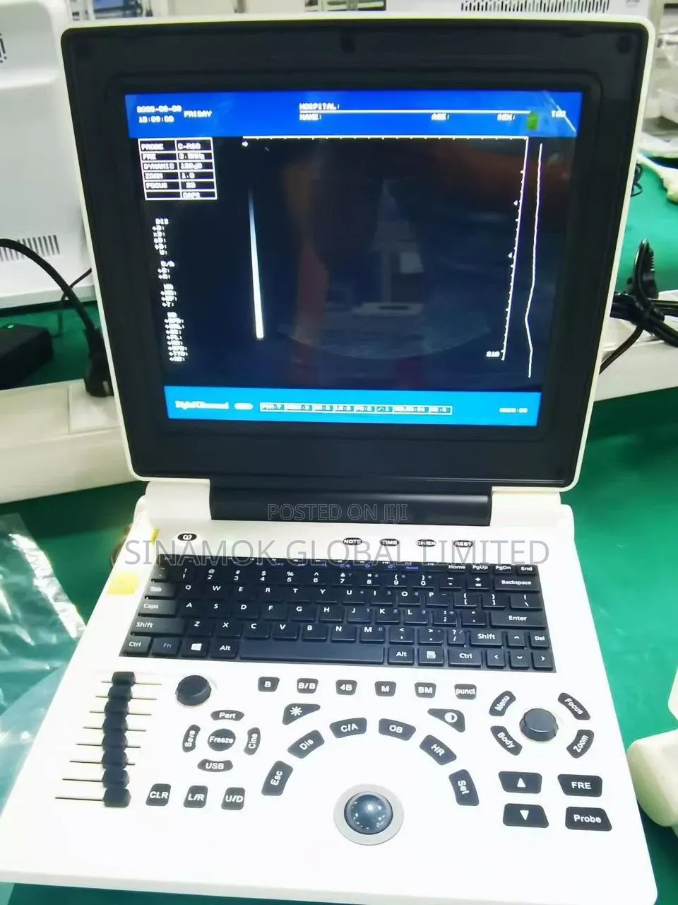 Ultrasound Scanner