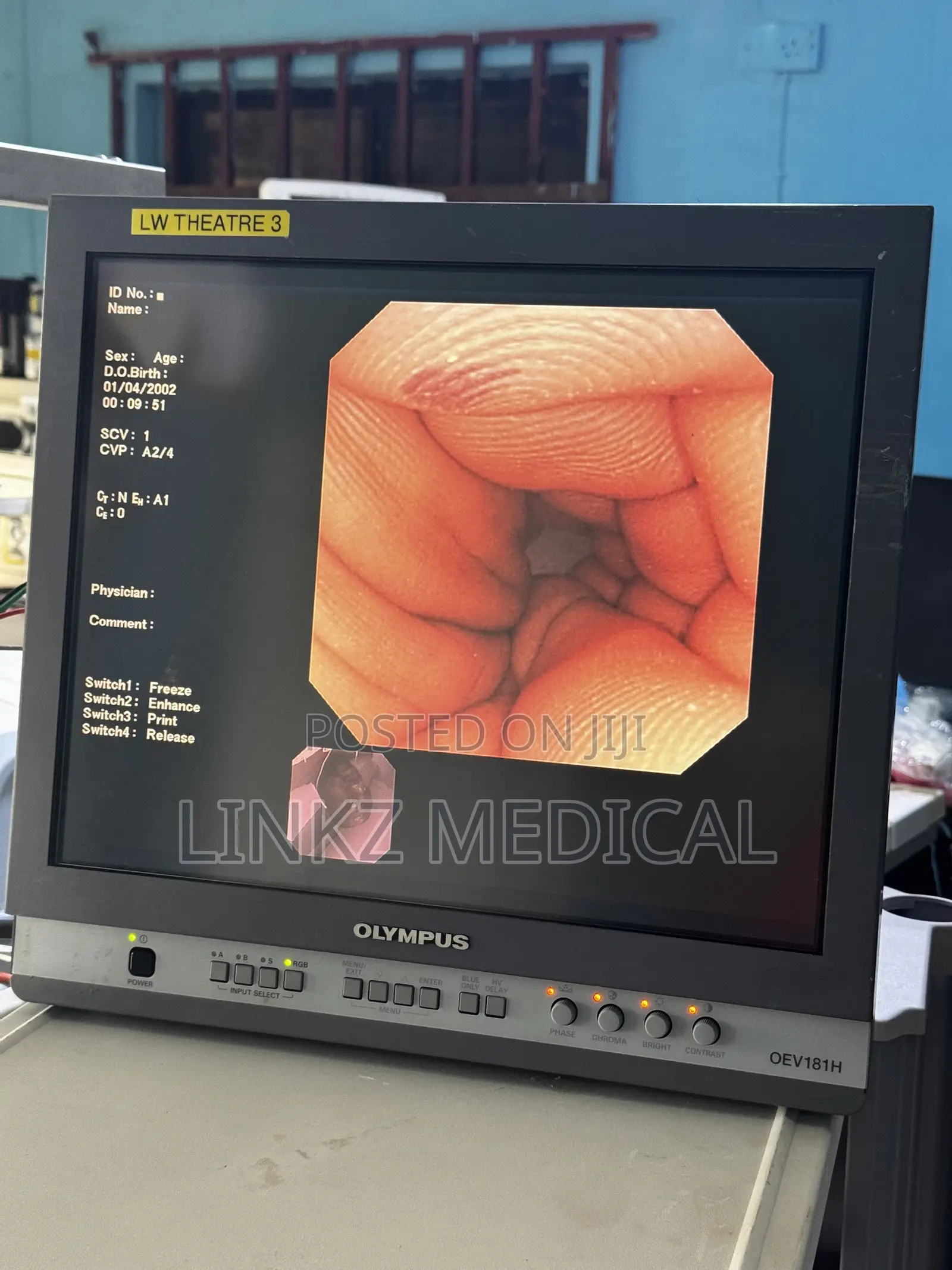 Complete Olympus CV260;CLV260 Endoscopy Wit Gastroscope N Colonoscopy