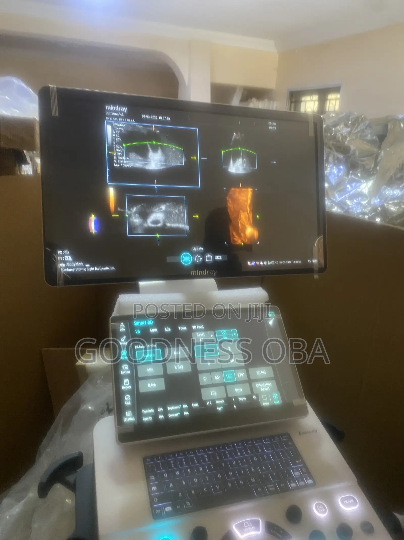 Mindray Consona N5 Ultrasound Machine