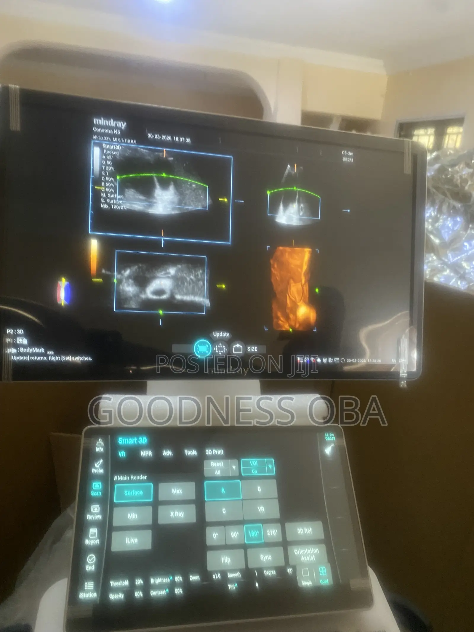 Mindray Consona N5 Ultrasound Machine