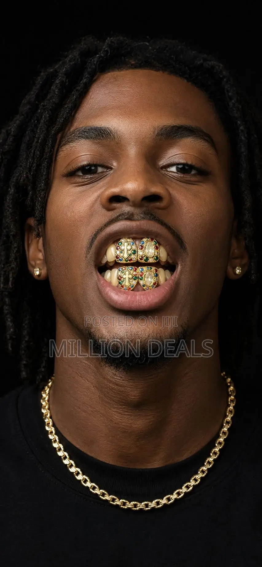 Iced Luxe Unique Teeth Gold Hip Hop Grillz