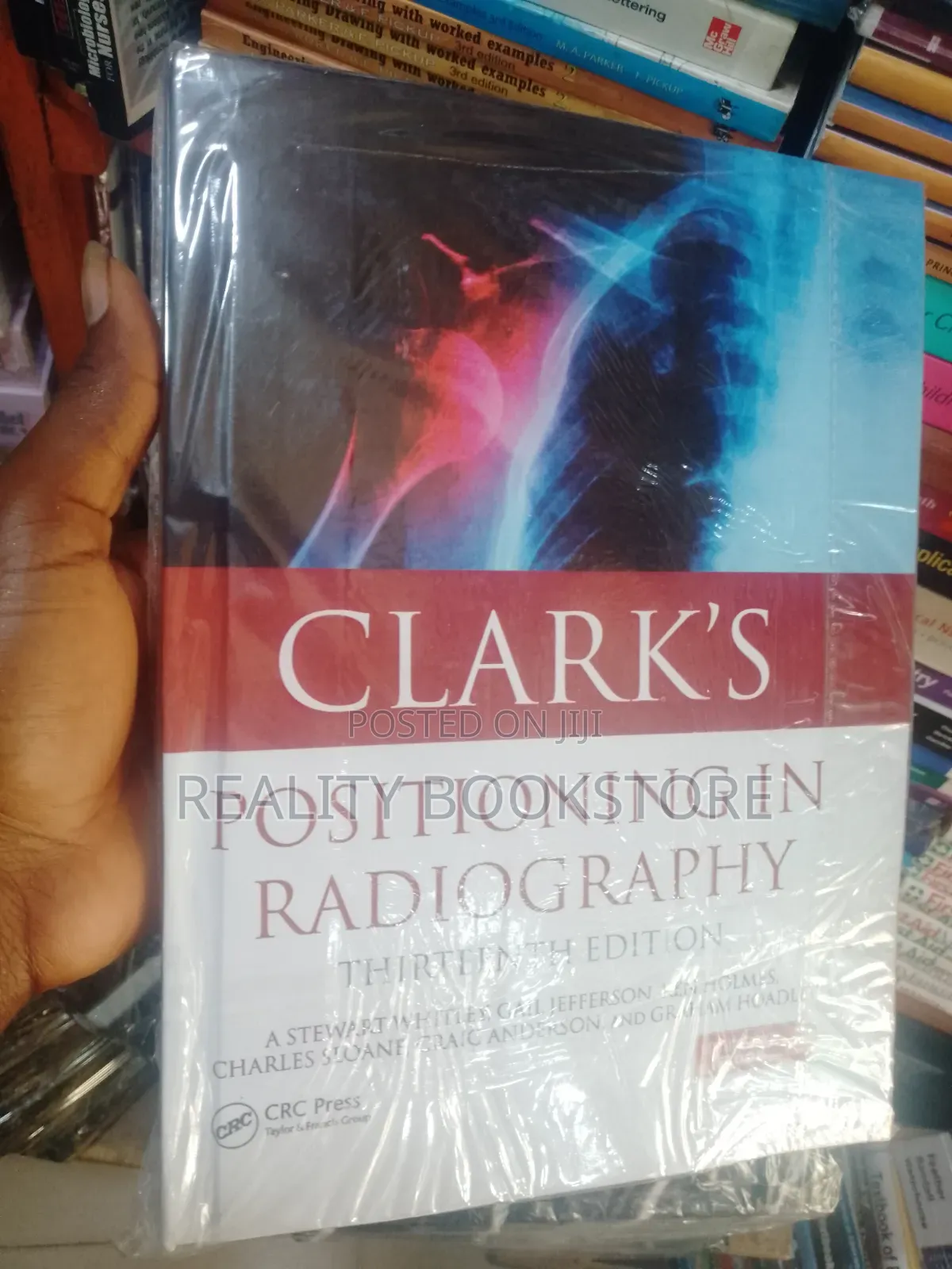 Clark Positioning in Radiography