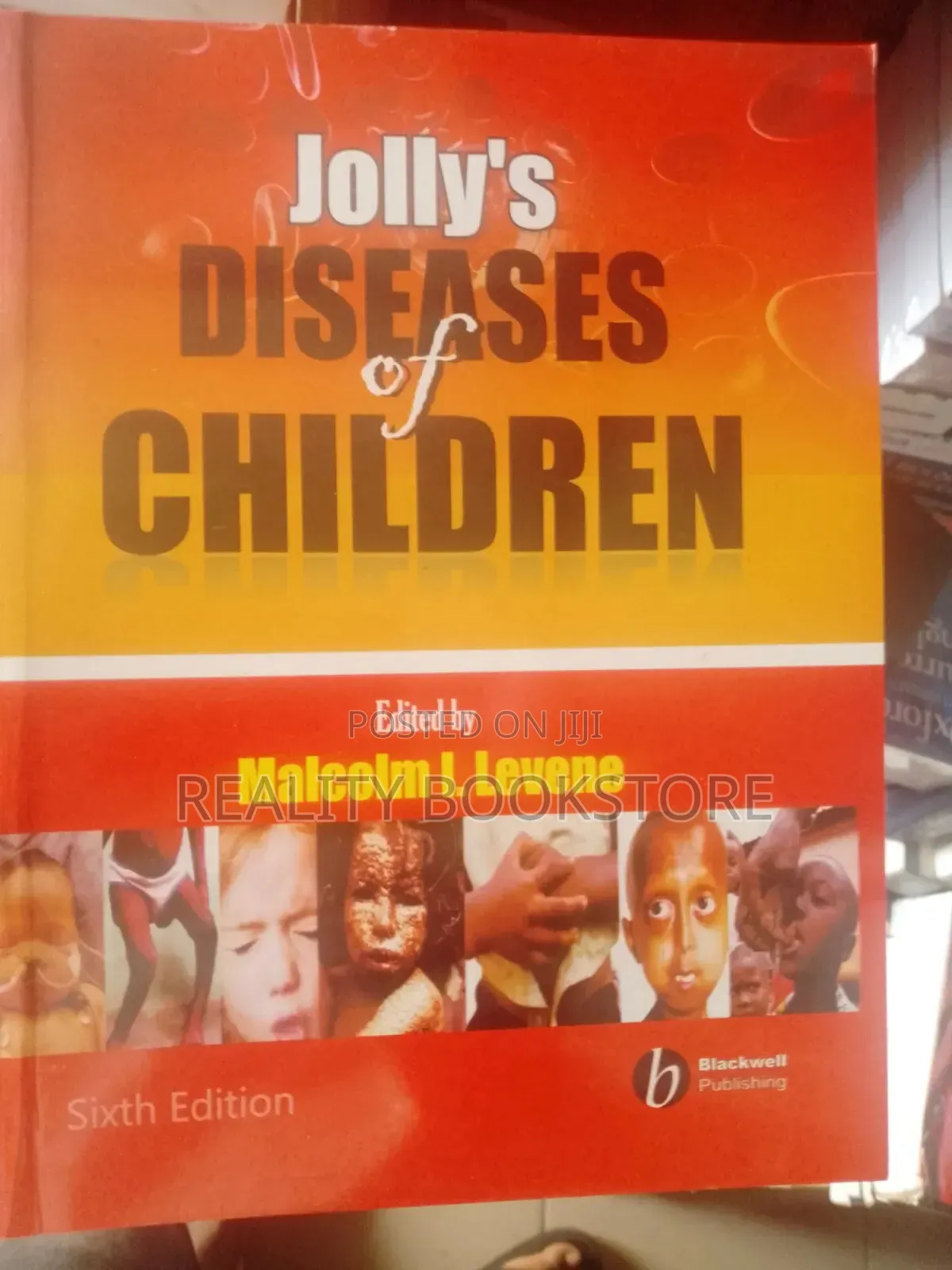 Jolly Disease of Children