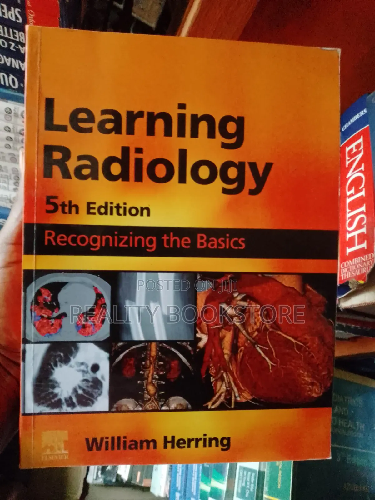 Learning Radiology