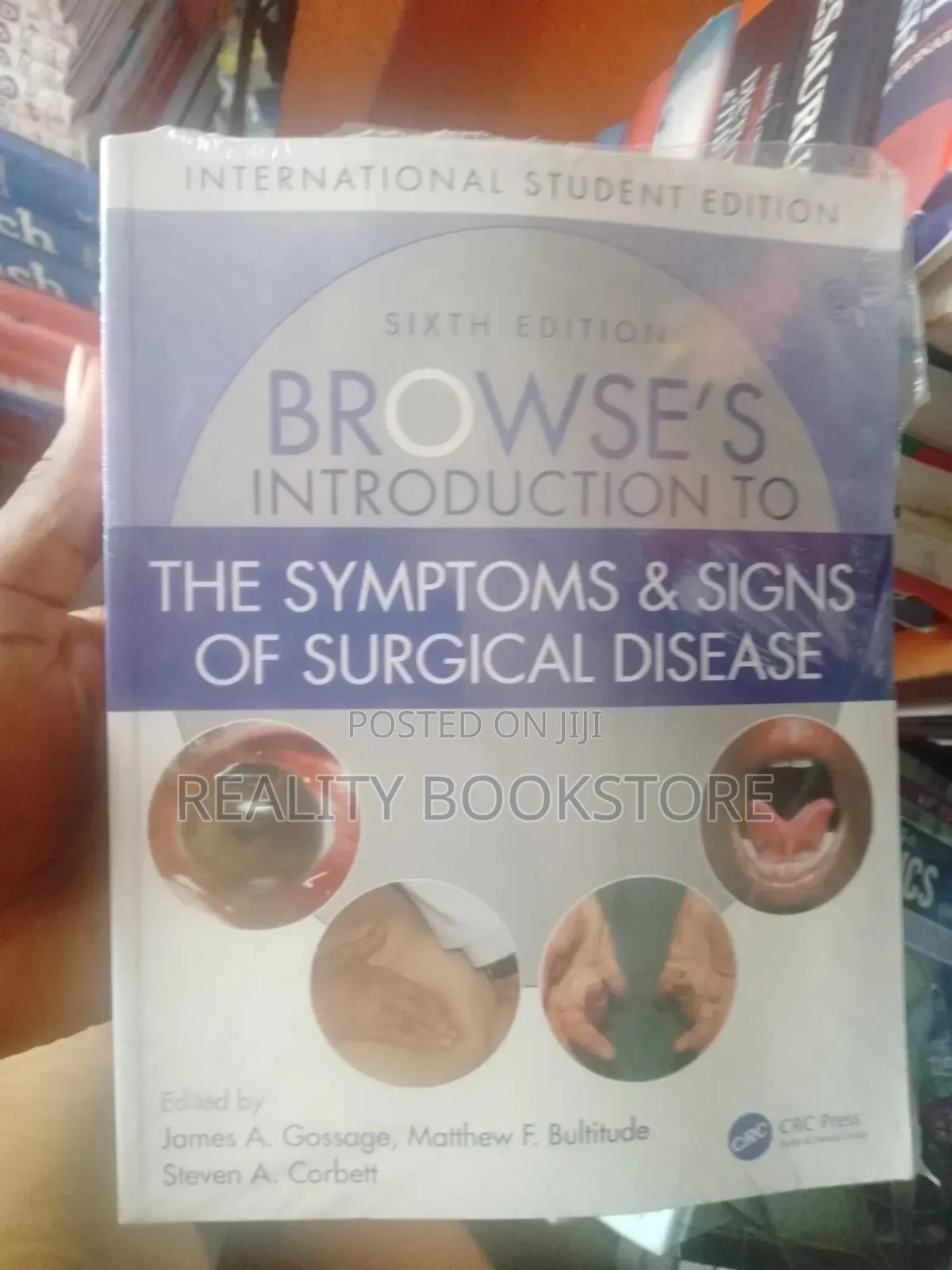 Browse Introduction to Symptoms and Sighs of Surgical Disease