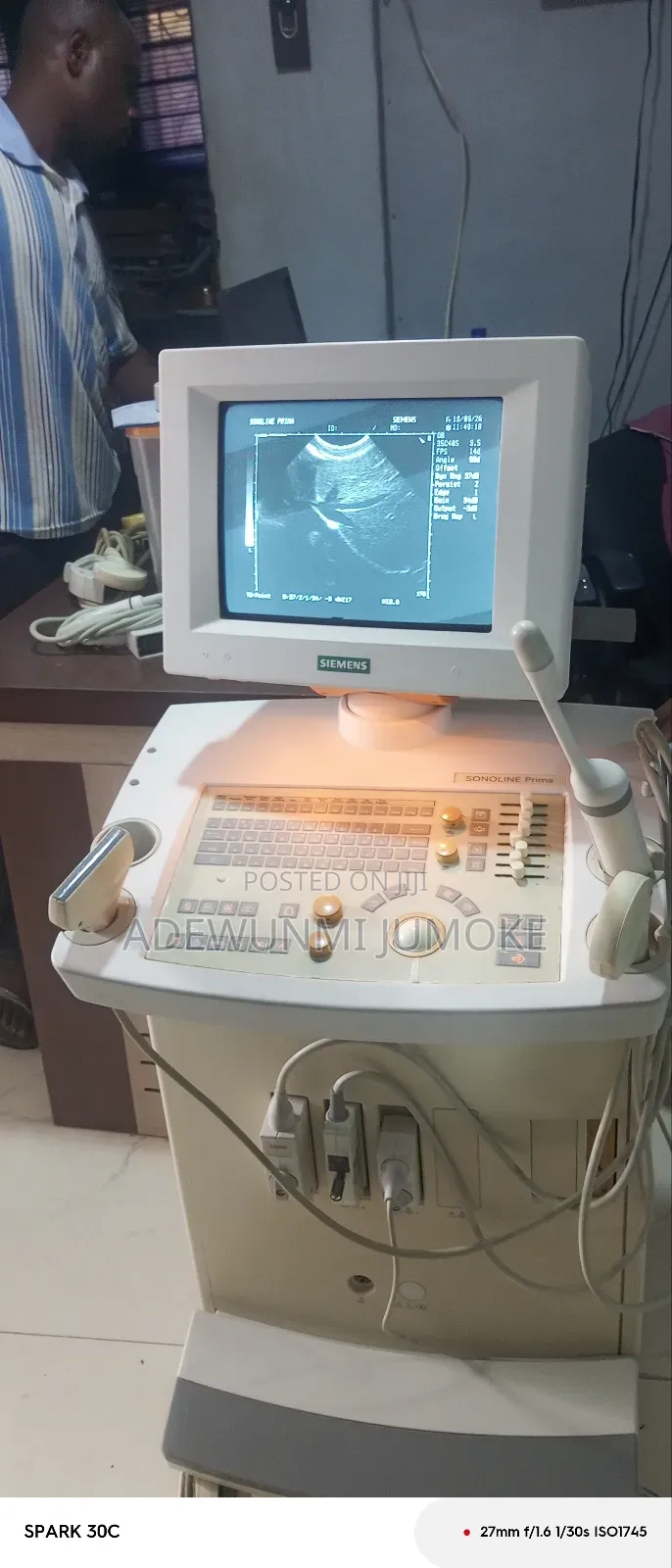 Siemens Prima With TVs Probe Linear, Convex