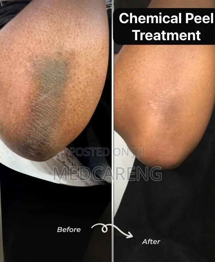 Facial Treatment in Ajah Lagos