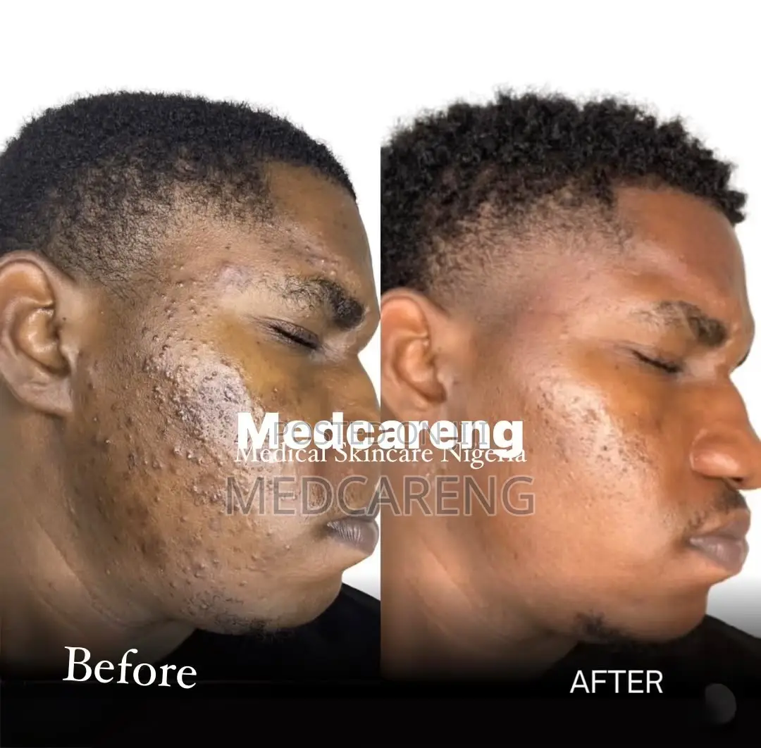 Facial Treatment in Ajah Lagos