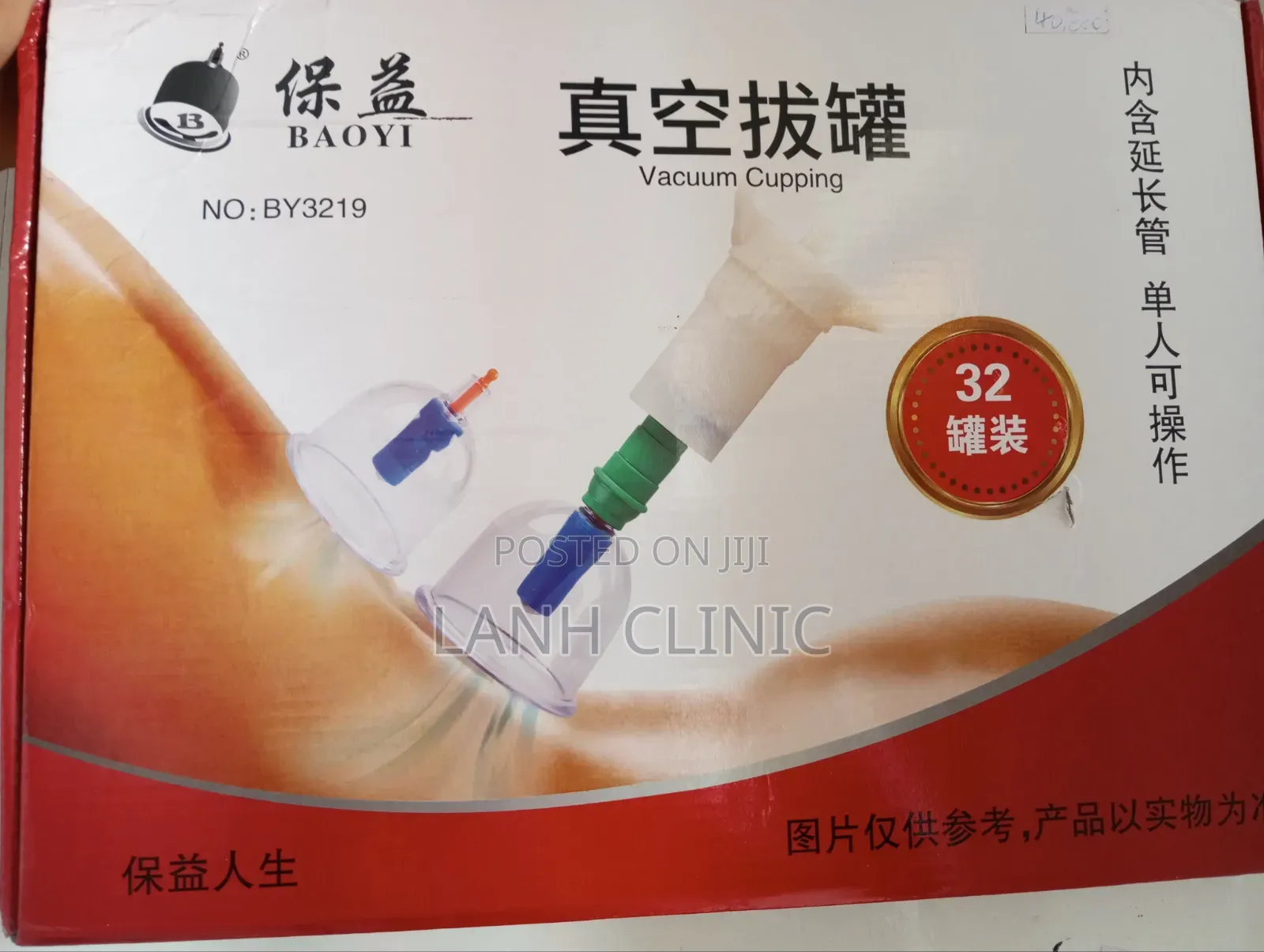 Cupping Set 32 Cup