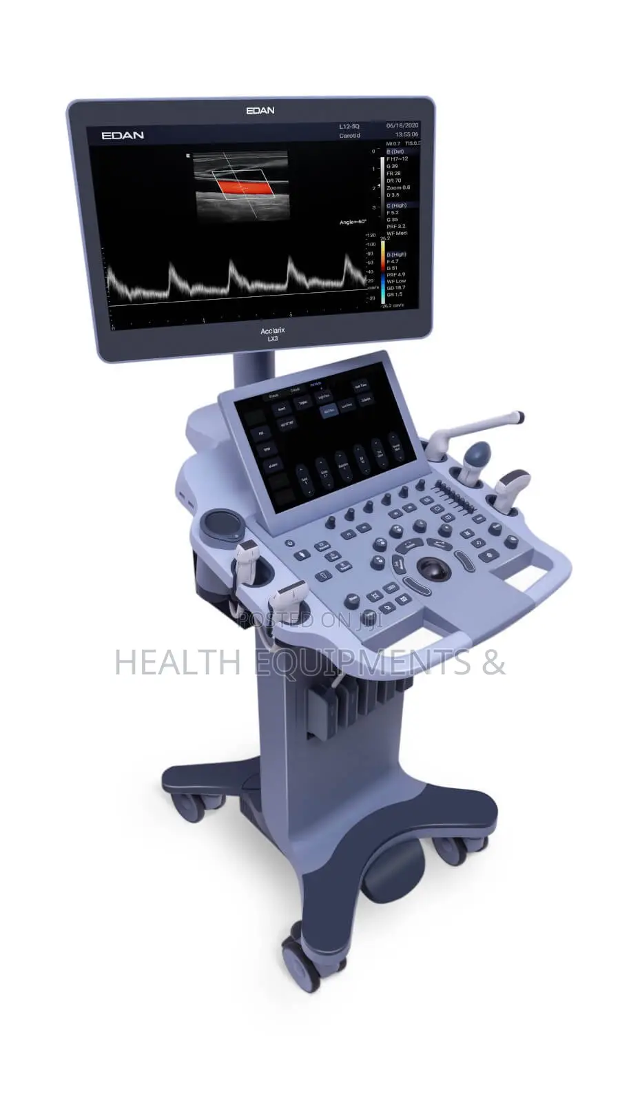 EDAN Acclarix LX3 Diagnostic Ultrasound System