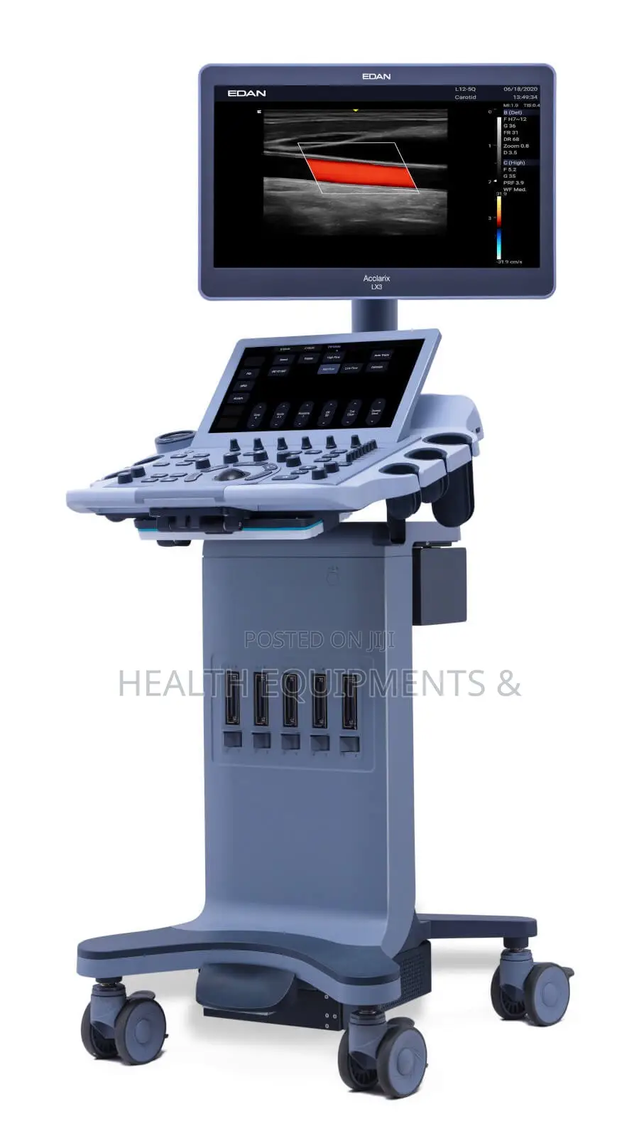 EDAN Acclarix LX3 Diagnostic Ultrasound System