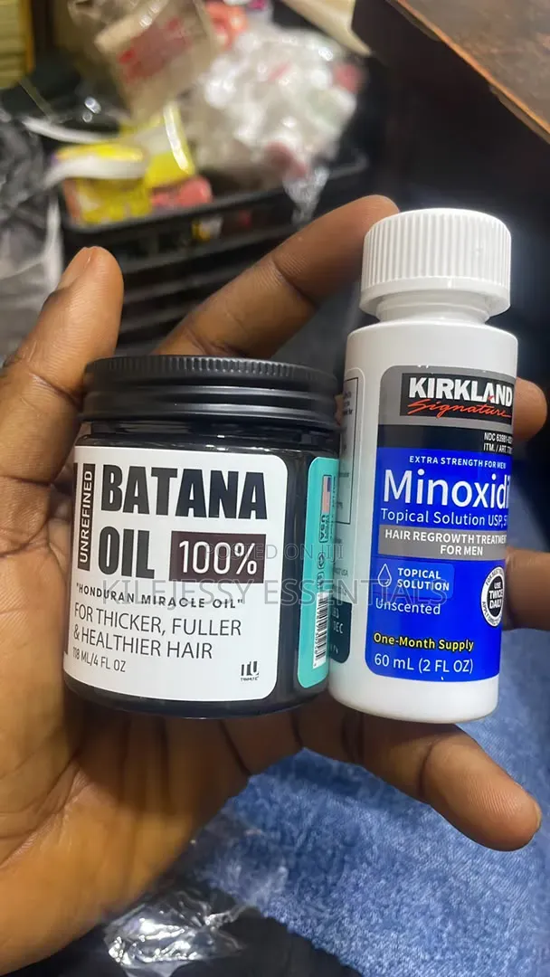 Hair Growth Combo — Batana Oil + Minoxidil Serum + Dermaroller
