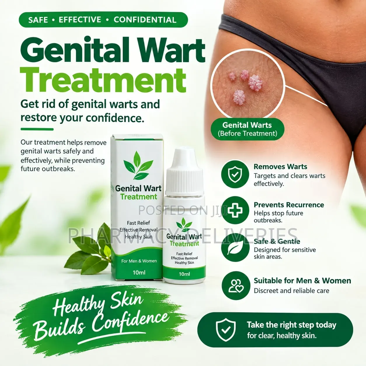 Genital Warts Removal Treatment – Painless & Complete Elimination!