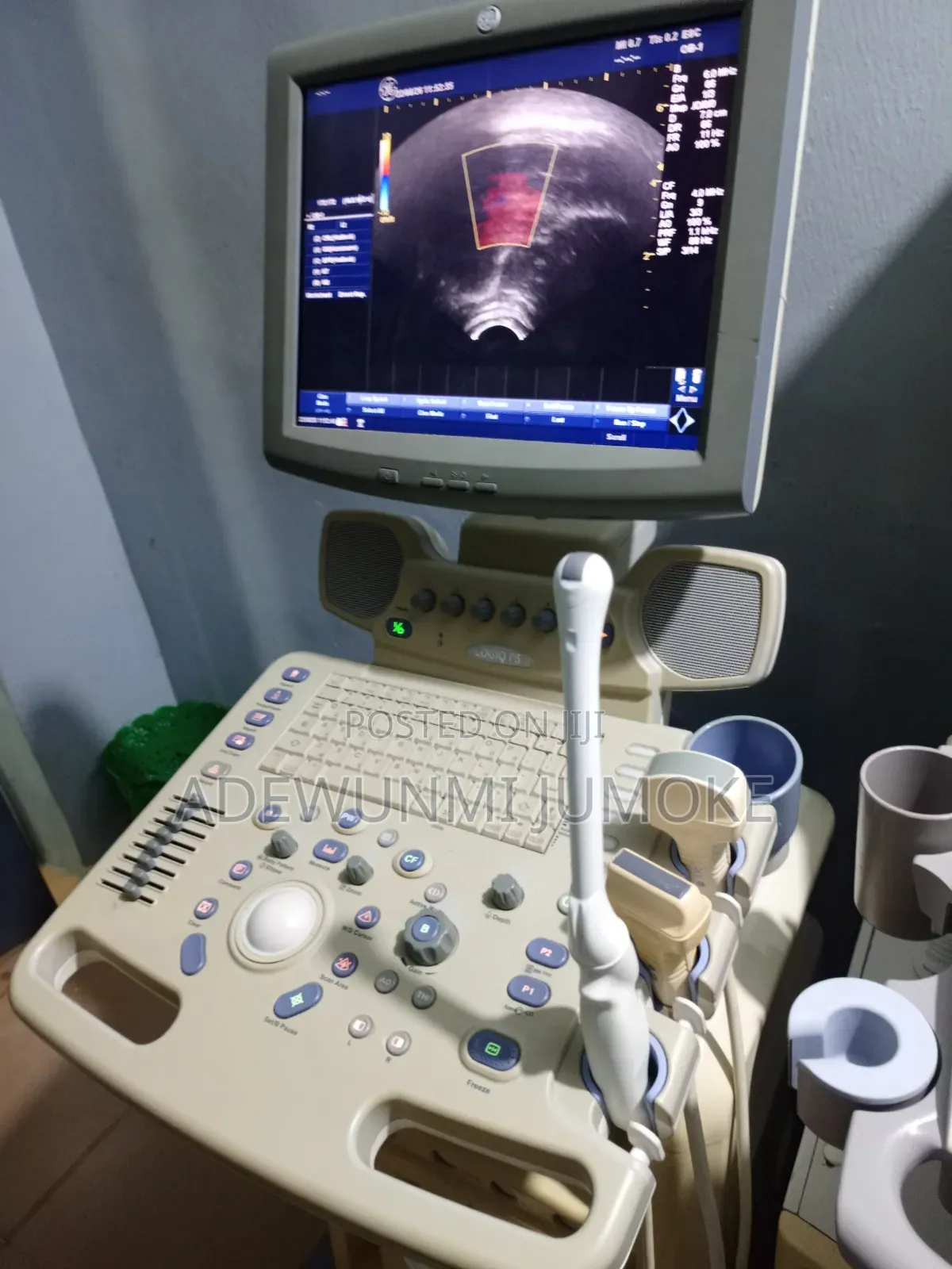 Logiq P5 With Convex, Liner, TVS Probe