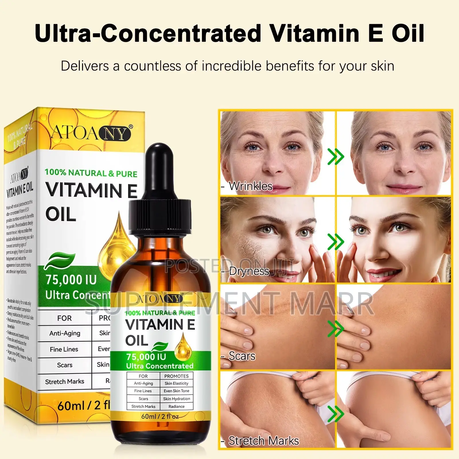 100% Natural & Pure Vitamin E Oil 75,000 lU Ultra Concentrated