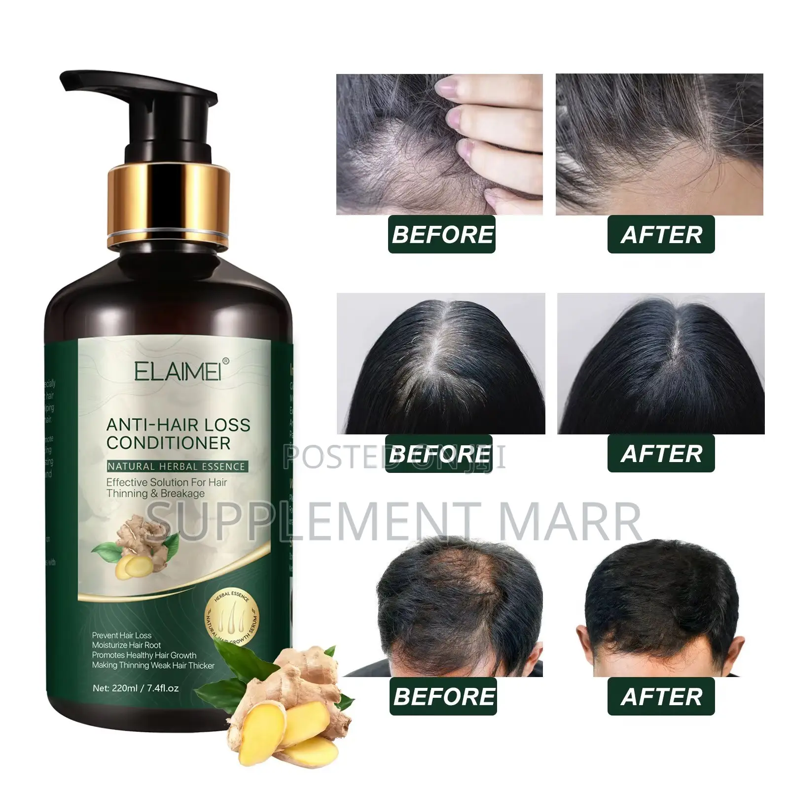 Anti-Hair Loss Conditioner – Effective for Hair Thinning & Breakage