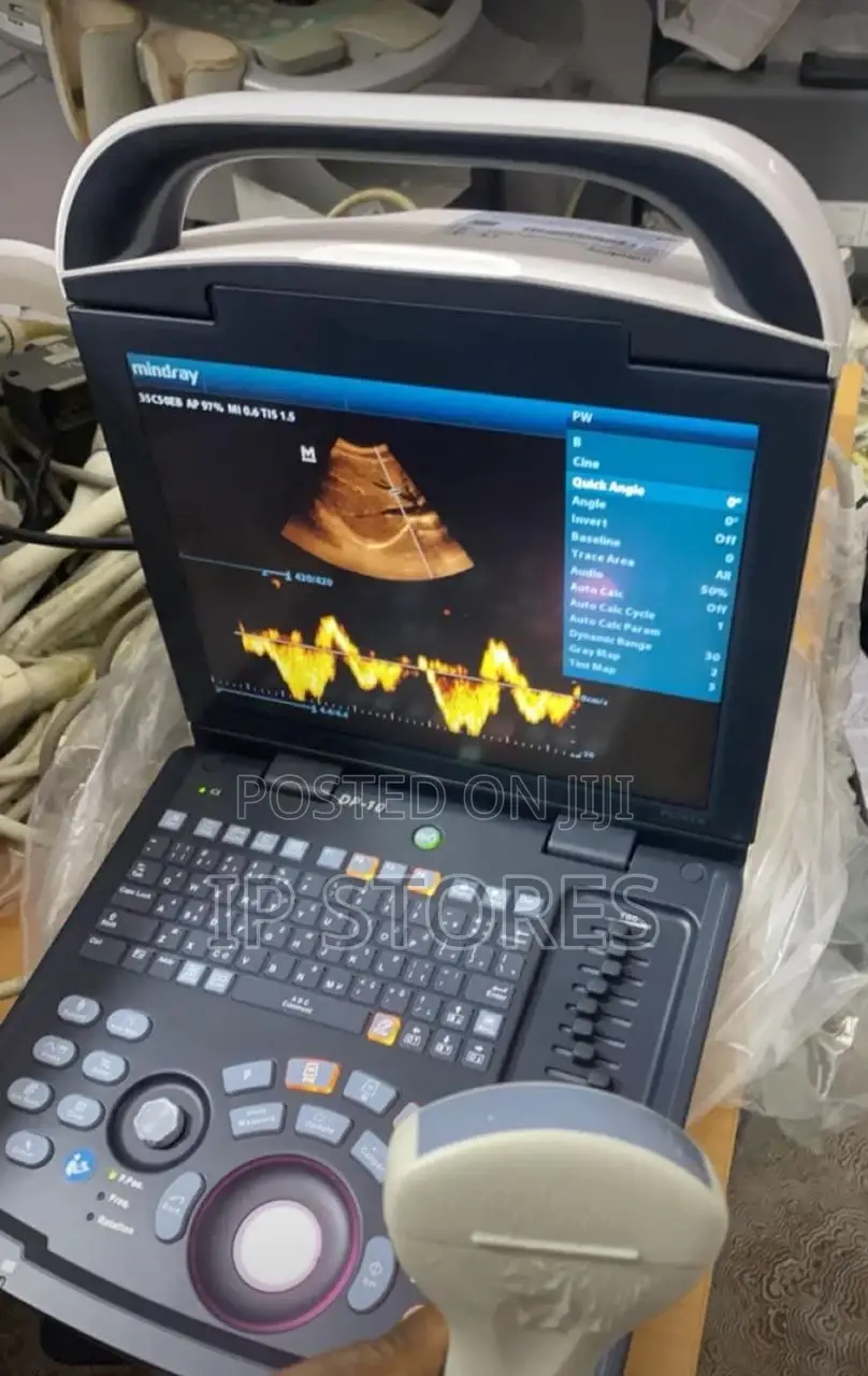 Ultrasound Machines/ Probes