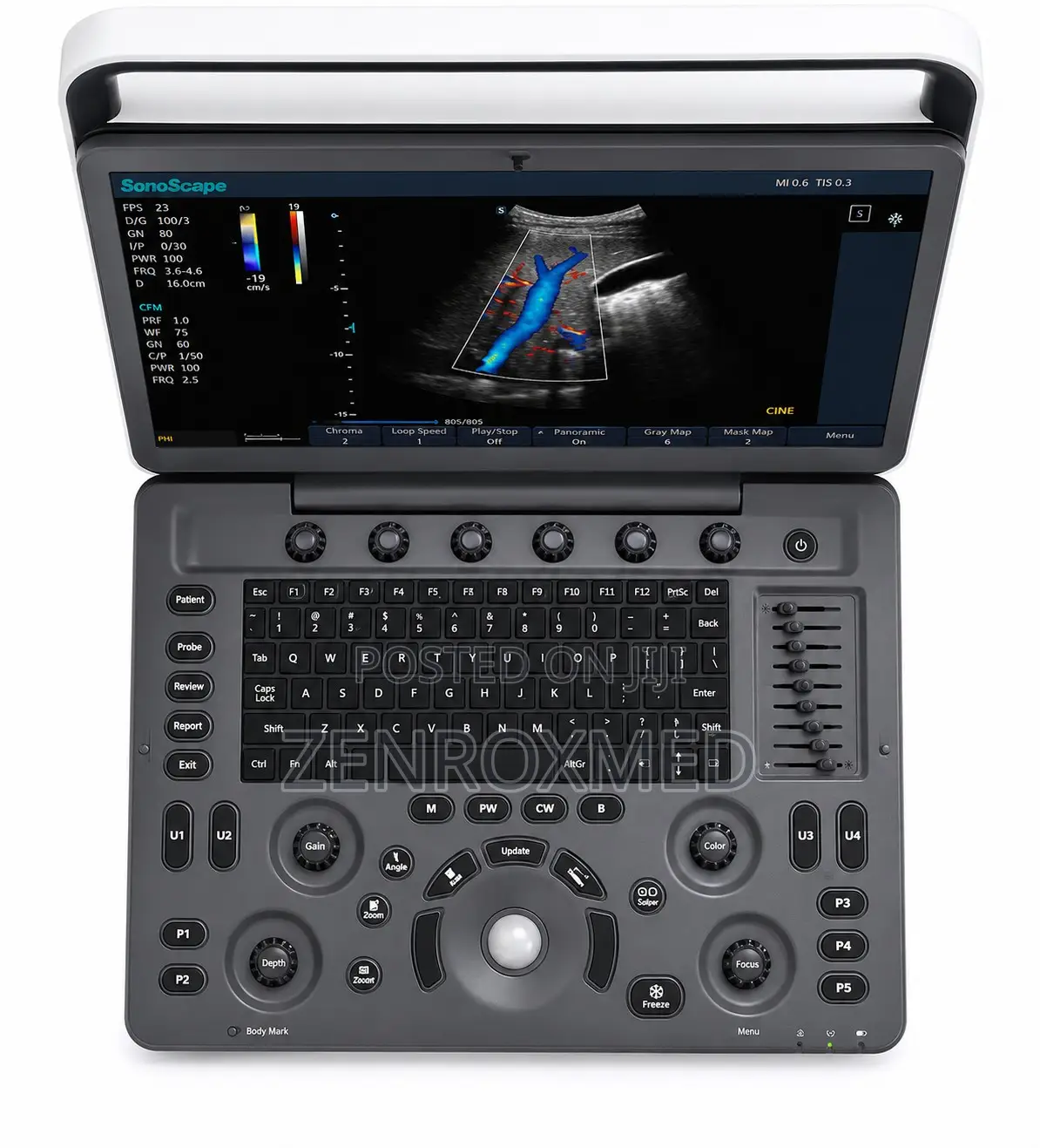 Sonoscape E2 Portable Ultrasound Machine
