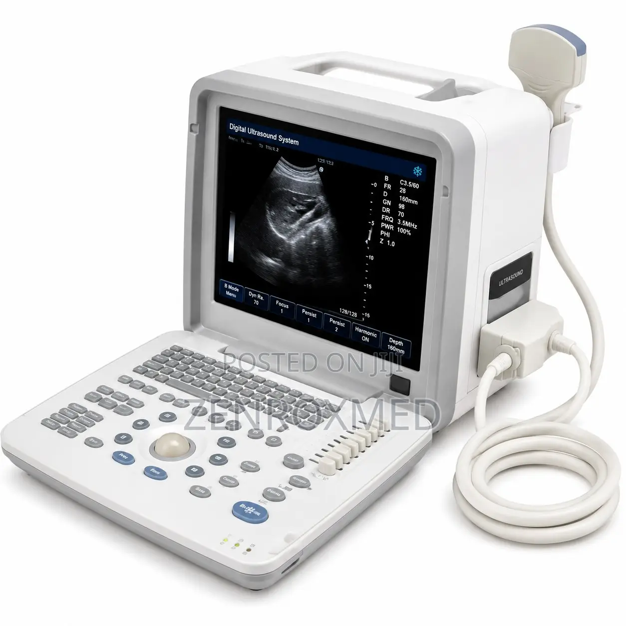 Portable B/W Ultrasound Machine (Non-Mindray)
