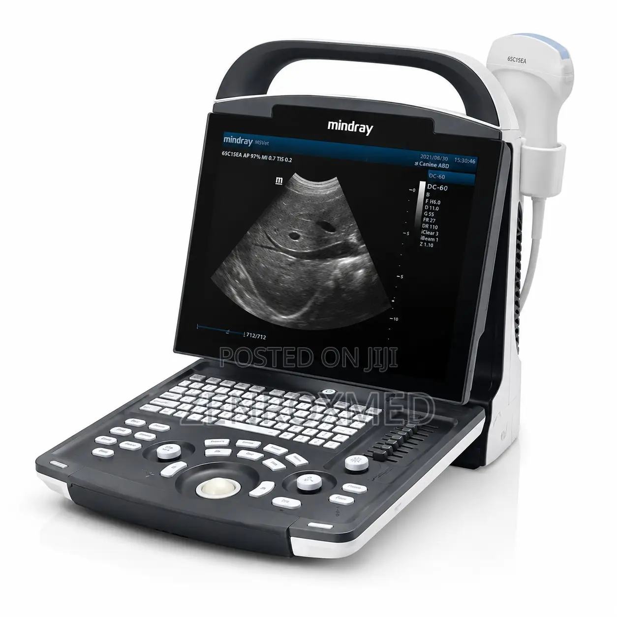 Mindray DP10 Portable Ultrasound System (1 Probe Included)
