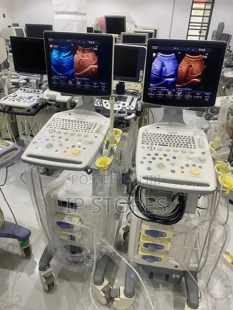 Ultrasound Scans