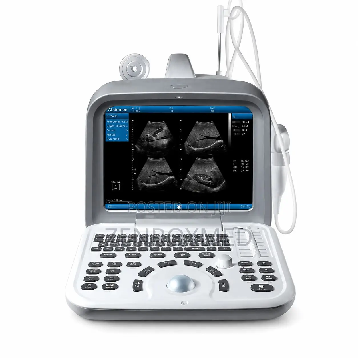 Zoncare I50 Full Digital B-Mode Ultrasound System