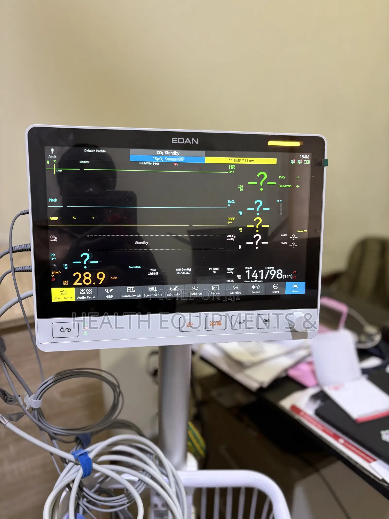 EDAN UX12 Patient Monitor With ETCO2