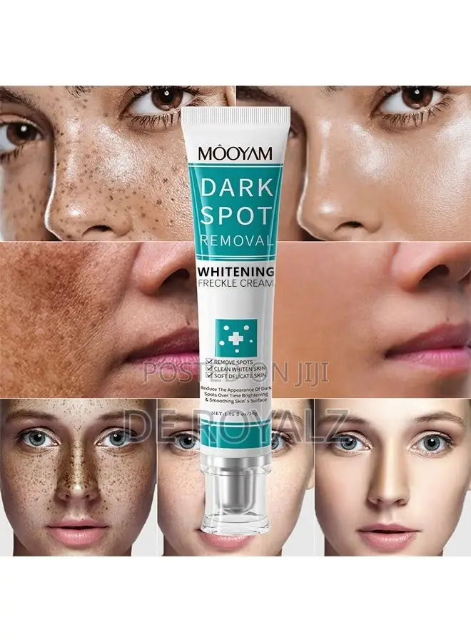 Mooyam Dark Spots Removal