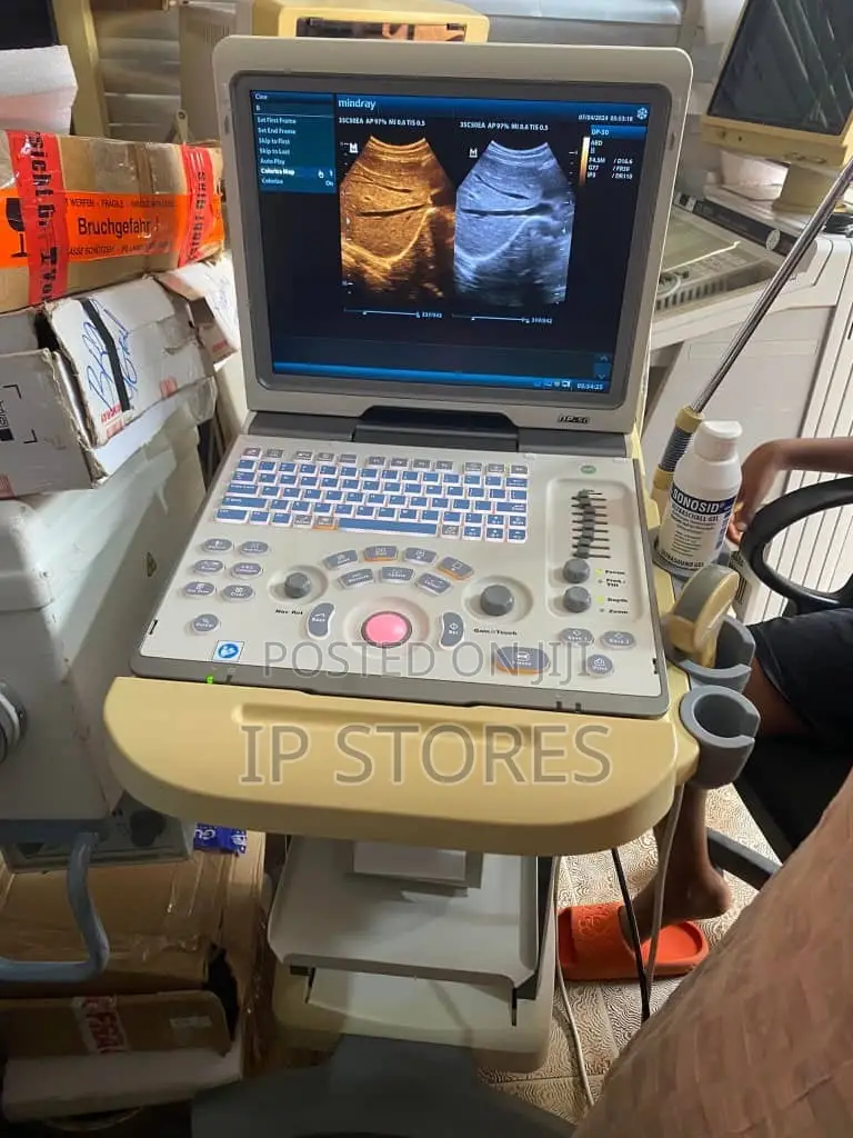 Ultrasound Machine