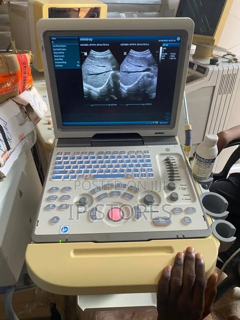 Ultrasound Machine