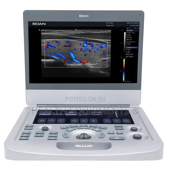 EDAN Acclarix AX3 Portable Color Doppler Ultrasound Machine