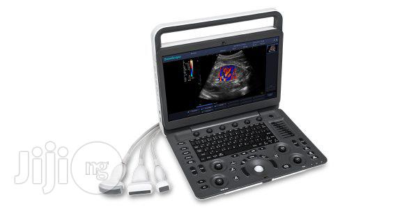 Sonoscape E3 Ultrasound