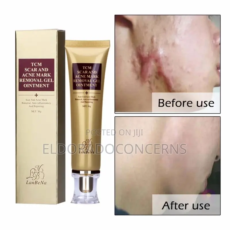 TCM Labena Skin Scar Cream