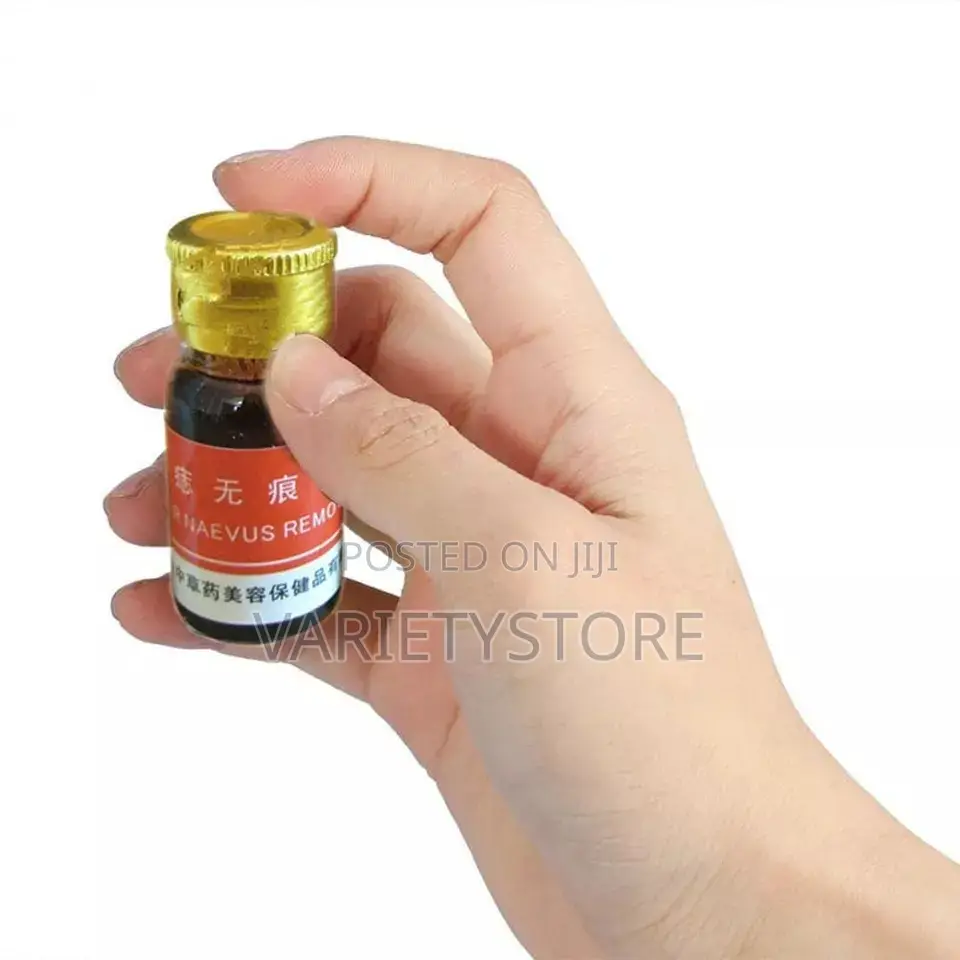 Moles, Warts, Freckles Skin Tags Removal Solution