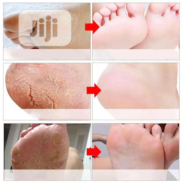 Exfoliating Foot Peel Mask
