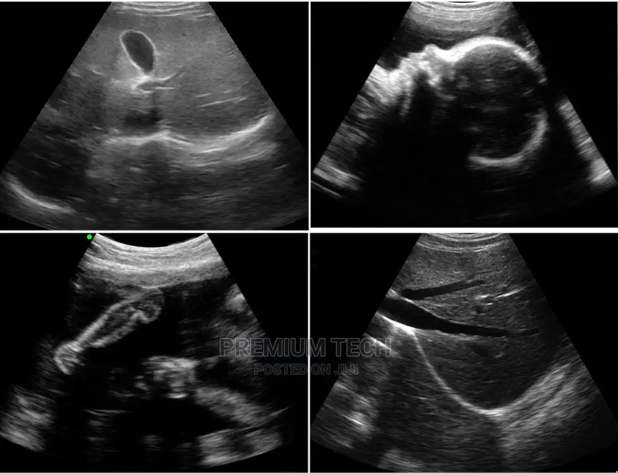 Wifi Wireless Portable Ultrasound Scanner Convex Array Probe