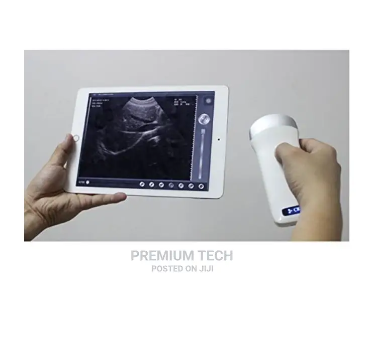 Wifi Wireless Portable Ultrasound Scanner Convex Array Probe